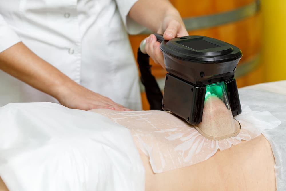 soins cryopolise